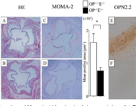 Figure From Osteopontin Deficiency Attenuates Atherosclerosis In