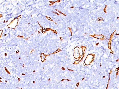 CD34 (Hematopoietic Stem Cell and Endothelial Marker) Monoclonal Antibody (SPM123) (947-MSM2X-P1)