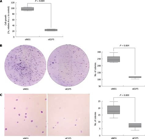 Figure From A Potential Oncogenic Role Of The Commonly Observed E F