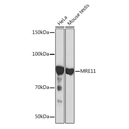 Mre11 Antibodies | Antibodies.com