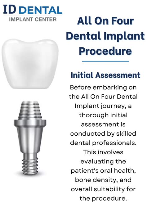 Ppt Unveiling The Advantages Of All On Four Dental Implant Powerpoint