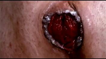 FREE Urethral Penetration Double Anal Deepthroat And More XVIDEOS