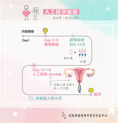 人工授孕iui 劉忠俊婦產科暨生殖醫學中心