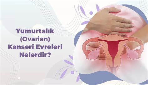 Ekol Kadın Doğum Yumurtalık Ovarian Kanseri Evreleri Nelerdir