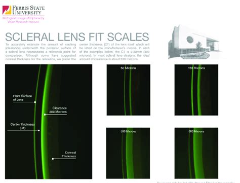 The Michigan College Of Optometry Scleral Lens Fit Scales For The