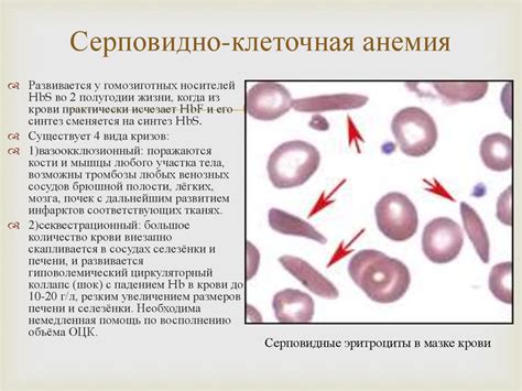 Гемолитическая анемия - презентация онлайн