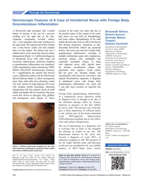 Pdf Dermoscopic Features Of A Case Of Intradermal Nevus With Foreign