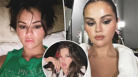 Selena Gomez Addresses Cosmetic Surgery Rumors And Shares Her Truth