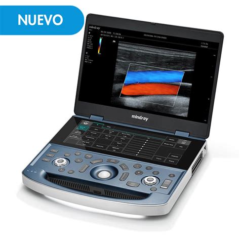 Ecógrafo Portátil Doppler Color Mindray ALLMEDICA Equipos Médicos