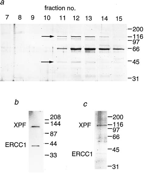 Xeroderma Pigmentosum Group F Caused By A Defect In A Structure