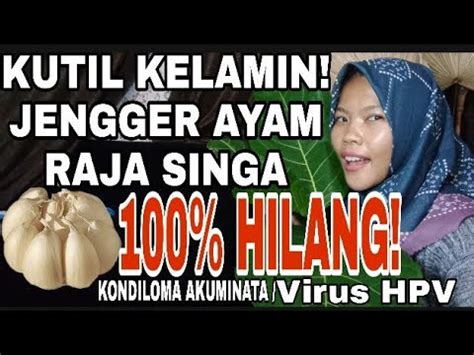 Virus Hpv Bisa Sembuh Total Kondiloma Bisa Disembuhkan Kutil Kelamin