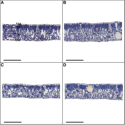 Leaf Cross Sections In Eucalyptus Urophylla Plants Sprayed With Ebr And