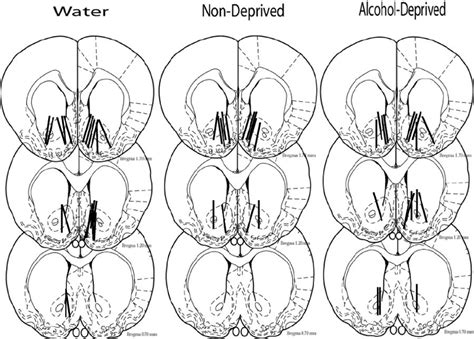 Location Of Representative Probe Placements In The Nucleus Accumbens