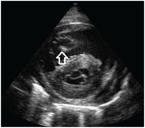 Dirofilarioses In Cats European Guidelines From The Abcd On Prevention