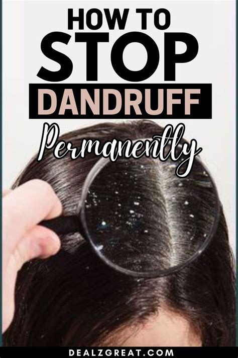 10 Best Tips To Get Rid Of Dandruff Fast Permanently At Home