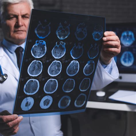 Best Neurologists In Calgary Updated 2024 Calgarys Best Rated