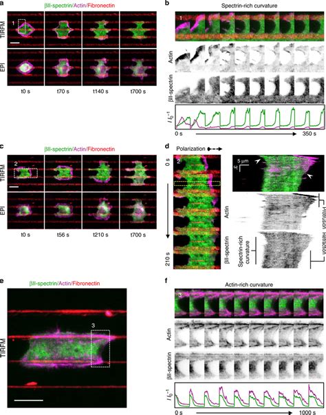 Fibroblasts Spreading Between Adhesive Lines Highlight Ii Spectrin And