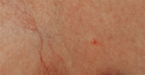 Close up of a Mark on Skin · Free Stock Photo