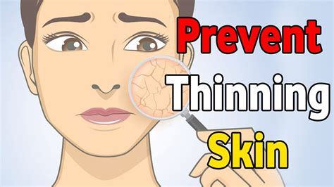 How To Treat And Prevent Thinning Skin Youtube