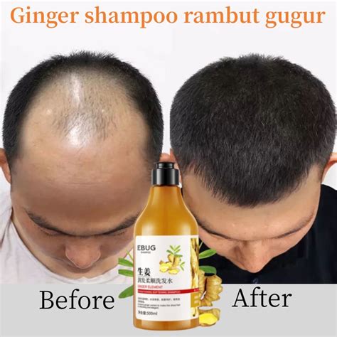 Shampoo Rambut Gugur Ginger Shampoo Hair Fall Shampoo Hair Loss