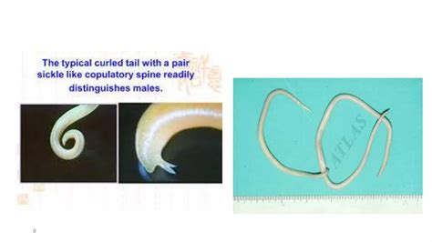 Ascaris Lumbricoides Ppt