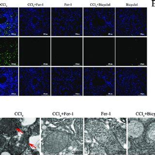 Bicyclol Inhibits CCl 4 Induced Hepatocellular Ferroptosis In Vivo A