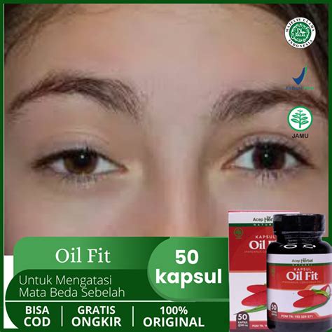 Obat Mata Beda Sebelah, Sipit Sebelah, Kelopak Mata Turun, Ptosis, Mata ...