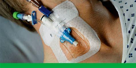 Applying Tegaderm Iv Dressing At Felipe Keith Blog