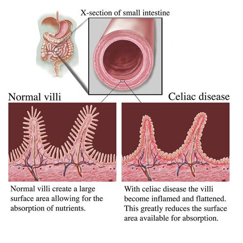 Cross Section Of Intestine Showing Photograph By Elise Walmsley Mac Wha