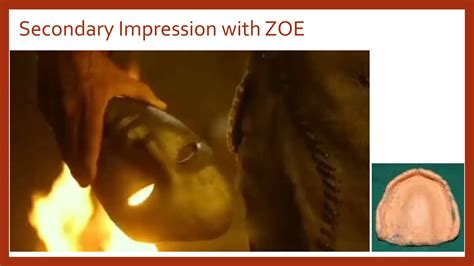 Impression Materials Part 1 Ppt