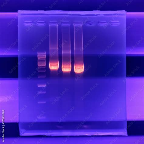 Result Of Agarose Gel Electrophoresis Of PCR Products Separation Of