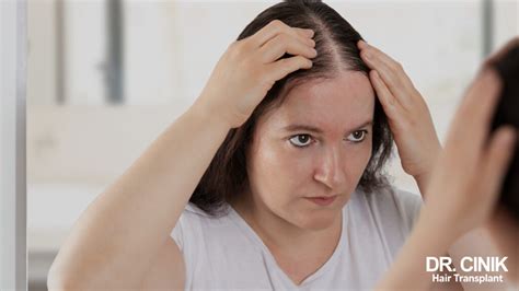 Hair Loss And Stress Understanding And Treating It Dr Cinik