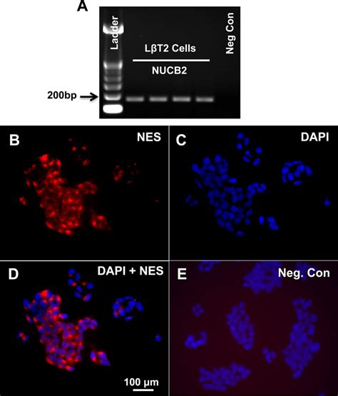 Presence Of Nucb Nesfatin In L T Cells Gel Image Showing A Bp