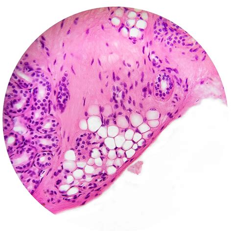 Connective Tissue | Histology and Histophathology 