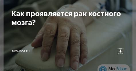 Как проявляется рак костного мозга? | medvisor.ru | Дзен