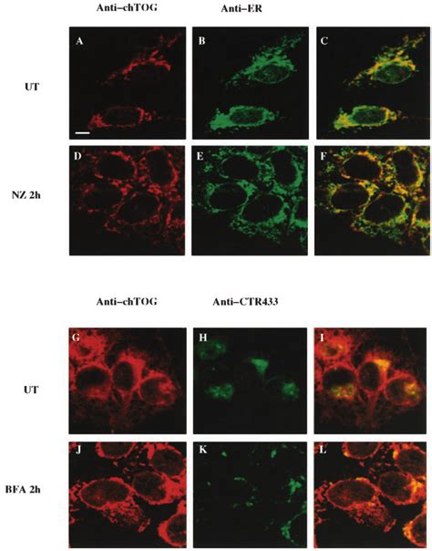 Subcellular Localization Of TOGp Protein In Interphasic Human Cells And