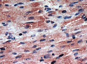 anti-cTnT antibody | Rabbit cTnT Polyclonal Antibody