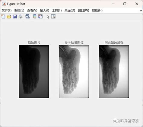 医学图像增强——基于同态滤波方法（matlab代码实现） 知乎