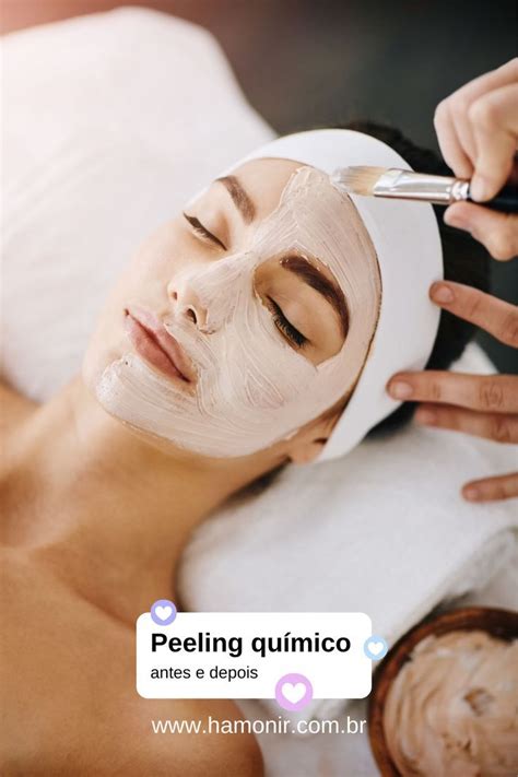 Você Sabe Quais São Os Benefícios Do Peeling Químico Antes E Depois O Peeling Químico é Um Dos