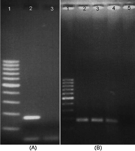 Agarose Gel Electrophoresis Of Rt Pcr A And Real Time Pcr B