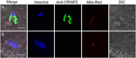 The Fate Of Porcine Sperm Crisp From The Perinuclear Theca Before And