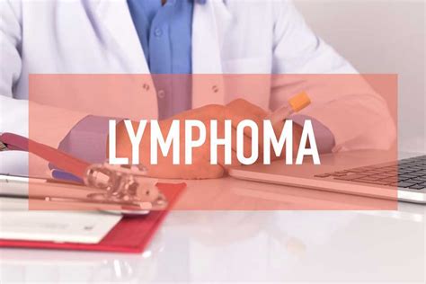 Expertopedia.net | Best Treatment Options for Non Hodgkin Lymphoma