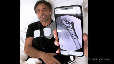 Habla Eugenio Derbez Por Primera Vez Desde Su Accidente Le Iban A