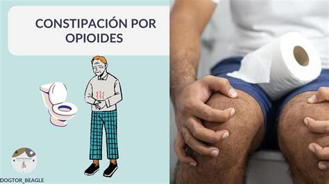 Constipación por opioides Dogtor Beagle uDocz