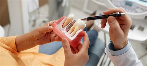 What's Better: Dental Implants and Partial Dentures? - North York Dental Clinic