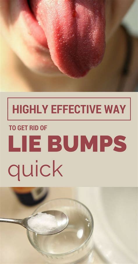 Highly Effective Way To Get Rid Of Lie Bumps Quick Bumps On Tongue Inflamed Taste Buds Sore