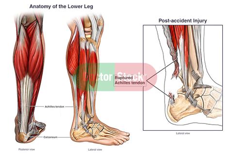 Leg Tendons