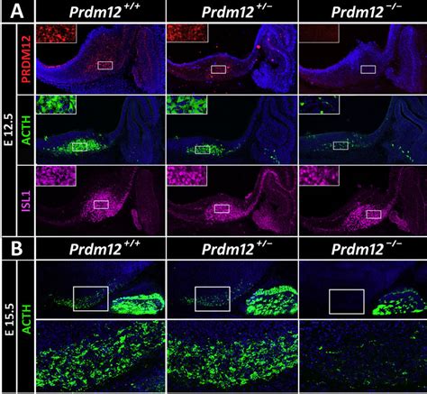 Hypothalamic Pomc Expression Is Impaired In Prdm12 Knockout Mice A