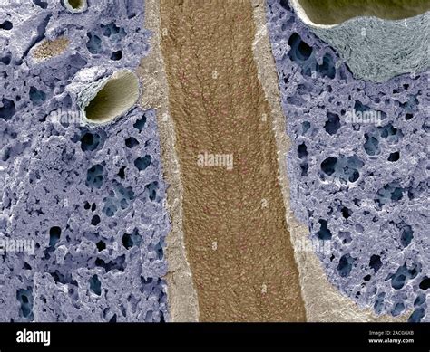 Lung Bronchus Cross Section Coloured Scanning Electron Micrograph Sem