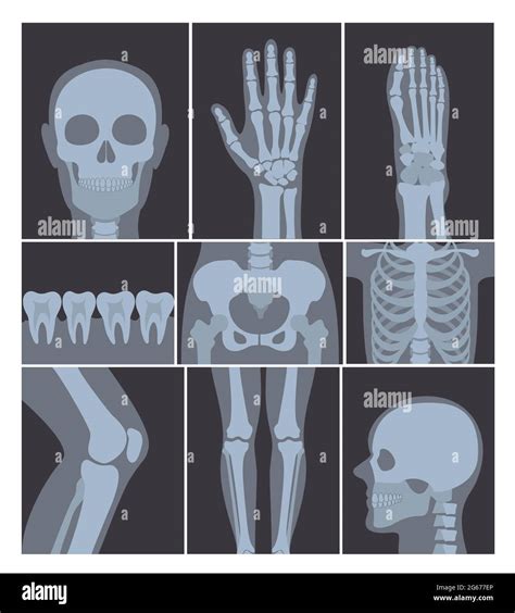 Radiografias del cuerpo humano fotografías e imágenes de alta